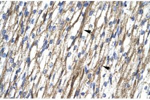 Rabbit Anti-RBM10 Antibody  Paraffin Embedded Tissue: Human Heart Cellular Data: Myocardial cells Antibody Concentration: 4. (RBM10 Antikörper  (N-Term))
