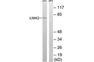 Western blot analysis of extracts from NIH-3T3 cells, treated with PMA 125ng/ml 30', using LIMK2 (Ab-283) Antibody.