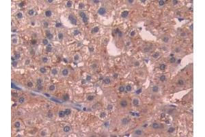 Detection of SIGIRR in Human Liver Tissue using Polyclonal Antibody to Single Ig IL1 Related Receptor (SIGIRR) (SIGIRR Antikörper  (AA 1-118))