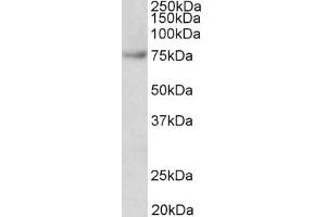 Western Blotting (WB) image for anti-Far Upstream Element (FUSE) Binding Protein 1 (FUBP1) (AA 160-174) antibody (ABIN5900708) (FUBP1 Antikörper  (AA 160-174))