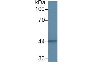 Western blot analysis of Human A431 cell lysate, using Human KRT15 Antibody (2 µg/ml) and HRP-conjugated Goat Anti-Rabbit antibody ( (KRT15 Antikörper  (AA 105-411))