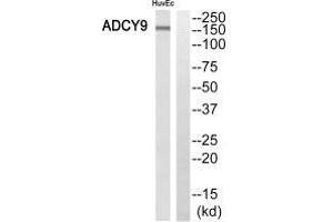 Western blot analysis of extracts from HuvEc cells, using ADCY9 antibody. (ADCY9 Antikörper  (N-Term))