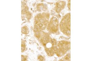anti-BRISC and BRCA1 A Complex Member 1 (BABAM1) (AA 175-225) antibody