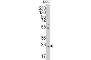 Western blot analysis of CD8B polyclonal antibody  in K-562 cell line lysates (35 ug/lane). (CD8B Antikörper  (N-Term))
