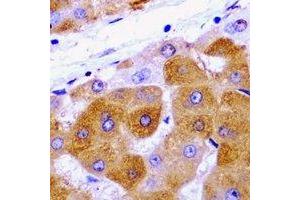 Immunohistochemical analysis of METTL7A staining in rat liver  formalin fixed paraffin embedded tissue section. (METTL7A Antikörper)