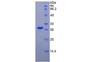 SDS-PAGE analysis of Rat Tafazzin Protein.