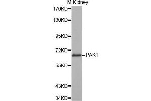 Western Blotting (WB) image for anti-P21-Activated Kinase 1 (PAK1) (AA 1-240) antibody (ABIN6219653) (PAK1 Antikörper  (AA 1-240))