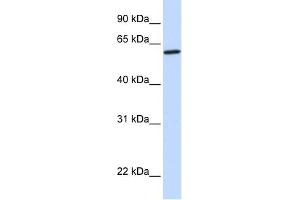 WB Suggested Anti-CYP27A1 Antibody Titration: 0. (CYP27A1 Antikörper  (Middle Region))