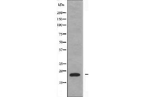 Western blot analysis of extracts from Jurkat cells using NBL1 antibody. (NBL1 Antikörper  (C-Term))