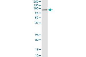 Immunoprecipitation of HAL transfected lysate using anti-HAL monoclonal antibody and Protein A Magnetic Bead , and immunoblotted with HAL MaxPab rabbit polyclonal antibody. (HAL Antikörper  (AA 558-658))
