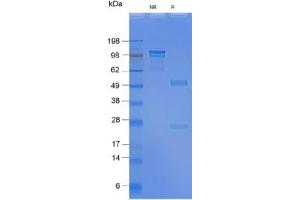SDS-PAGE gel: 2. (Rekombinanter SSEA-4 Antikörper)