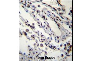 HIST1H2BN Antibdy (N-term) (ABIN657039 and ABIN2846210) immunohistochemistry analysis in formalin fixed and paraffin embedded human lung tissue followed by peroxidase conjugation of the secondary antibody and DAB staining. (HIST1H2BN Antikörper  (N-Term))