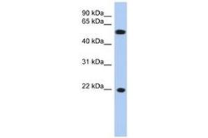 Image no. 1 for anti-Crystallin, gamma C (CRYGC) (AA 71-120) antibody (ABIN6743634) (CRYGC Antikörper  (AA 71-120))