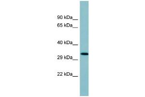 WB Suggested Anti-SFTPD Antibody Titration:  0. (SFTPD Antikörper  (Middle Region))