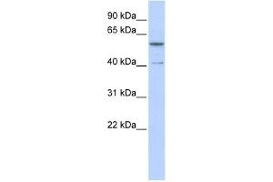 WB Suggested Anti-ZNF284 Antibody Titration:  0. (ZNF284 Antikörper  (C-Term))