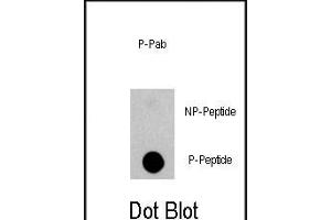 Dot blot analysis of anti-EGFR-p Phospho-specific Pab (ABIN1944845 and ABIN2839700) on nitrocellulose membrane. (EGFR Antikörper  (pSer1070))