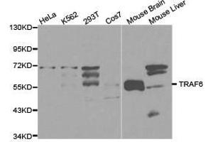 Western Blotting (WB) image for anti-TNF Receptor-Associated Factor 6 (TRAF6) antibody (ABIN1875195) (TRAF6 Antikörper)