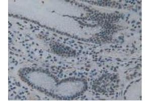 IHC-P analysis of Human Stomach Tissue, with DAB staining. (TOR1A Antikörper  (AA 33-321))