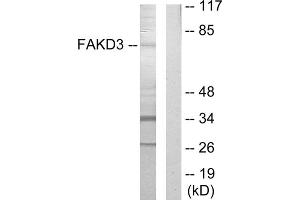 Western blot analysis of extracts from HepG2 cells, using FAKD3 antibody. (FASTKD3 Antikörper  (Internal Region))