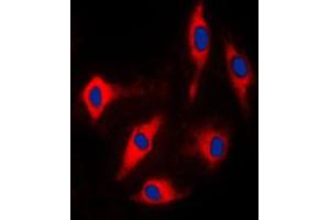 Immunofluorescent analysis of ARHGAP17 staining in Lovo cells.