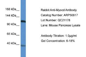 WB Suggested Anti-Myocd Antibody   Titration: 1. (Myocardin Antikörper  (N-Term))