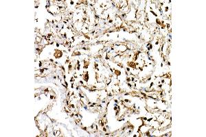 Immunohistochemistry of paraffin-embedded human lung using BHLHE40 Rabbit pAb (ABIN6129354, ABIN6137550, ABIN6137551 and ABIN6222195) at dilution of 1:150 (40x lens). (BHLHE40 Antikörper  (AA 173-412))