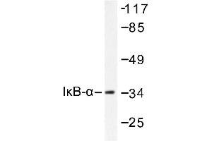 Image no. 1 for anti-Nuclear Factor of kappa Light Polypeptide Gene Enhancer in B-Cells Inhibitor, alpha (NFKBIA) antibody (ABIN265483) (NFKBIA Antikörper)