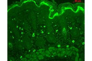Immunohistochemistry analysis using Rabbit Anti-TNF-R1 Polyclonal Antibody . (TNFRSF1A Antikörper  (AA 20-43))