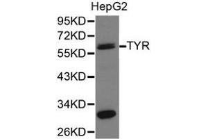 Western Blotting (WB) image for anti-Tyrosinase (TYR) antibody (ABIN1875241) (TYR Antikörper)
