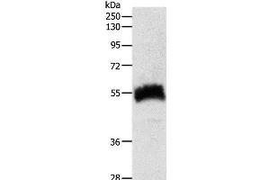 Western Blot analysis of Human fetal kidney tissue using SLC22A6 Polyclonal Antibody at dilution of 1:600