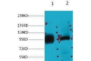 Western Blot (WB) analysis of 1) HeLa, 2) 293T, diluted at 1:2000. (ABCB5 Antikörper)