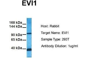 Host: Rabbit Target Name: EVI1 Sample Tissue: Human 293T Antibody Dilution: 1. (MECOM Antikörper  (C-Term))