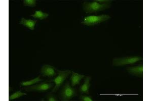 Immunofluorescence of purified MaxPab antibody to FGF13 on HeLa cell. (FGF13 Antikörper  (AA 1-245))