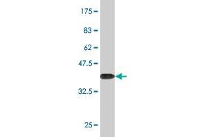 Western Blotting (WB) image for anti-Interleukin-1 Receptor-Associated Kinase 1 (IRAK1) (AA 530-693) antibody (ABIN561510)