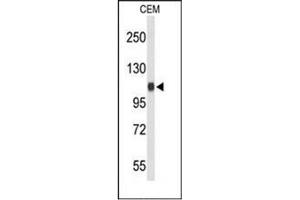Western blot analysis of RanBP11 / Importin-11 Antibody (C-term) Cat. (Importin 11 Antikörper  (C-Term))
