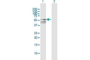 Western Blot analysis of RBMY1F expression in transfected 293T cell line by RBMY1F MaxPab polyclonal antibody. (RBMY1F Antikörper  (AA 1-496))