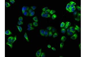 Immunofluorescence staining of PC-3 cells with ABIN7147166 at 1:100, counter-stained with DAPI. (CD59 Antikörper  (AA 26-102))
