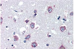 Human Brain, Cortex (formalin-fixed, paraffin-embedded) stained with NPC1 antibody ABIN462125 followed by biotinylated anti-mouse IgG secondary antibody ABIN481714, alkaline phosphatase-streptavidin and chromogen. (NPC1 Antikörper)
