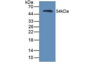 Detection of Recombinant Kim1, Human using Monoclonal Antibody to Kidney Injury Molecule 1 (Kim1) (HAVCR1 Antikörper  (AA 21-240))