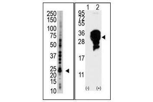 Image no. 1 for anti-Ubiquitin-Conjugating Enzyme E2S (UBE2S) (C-Term) antibody (ABIN357498) (UBE2S Antikörper  (C-Term))