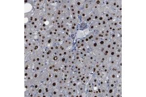 Immunohistochemical staining (Formalin-fixed paraffin-embedded sections) of human liver with PTPN1 polyclonal antibody  shows strong nuclear positivity in hepatocytes. (PTPN1 Antikörper  (AA 268-406))
