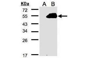 WB Image Western Blot analysis of RASSF9 expression in transfected 293T cell line by RASSF9 polyclonal antibody. (RASSF9 Antikörper  (C-Term))