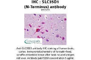 Image no. 1 for anti-Solute Carrier Family 35 (UDP-Glucuronic Acid/UDP-N-Acetylgalactosamine Dual Transporter), Member D1 (SLC35D1) (N-Term) antibody (ABIN1739364) (SLC35D1 Antikörper  (N-Term))