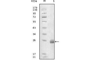 Western blot analysis using FBLN5 mouse mAb against truncated FBLN5-His recombinant protein. (Fibulin 5 Antikörper)