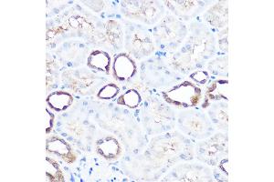 Immunohistochemistry of paraffin-embedded rat kidney using HSP70/HSP Rabbit pAb  at dilution of 1:100 (40x lens). (HSP70 1A Antikörper  (C-Term))