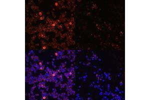 Immunofluorescence analysis of Jurkat cells using Phospho-Z-Y493 Rabbit pAb (ABIN3020534, ABIN3020535, ABIN3020536, ABIN1682145 and ABIN1682146) at dilution of 1:100 (40x lens). (ZAP70 Antikörper  (pTyr493))