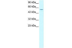 WB Suggested Anti-LHX6 Antibody Titration:  1. (LHX6 Antikörper  (C-Term))