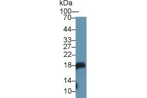 Detection of GKN1 in Mouse Stomach lysate using Polyclonal Antibody to Gastrokine 1 (GKN1)