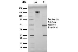 SDS-PAGE Analysis Purified N-Cadherin Mouse Monoclonal Antibody (8C11). (N-Cadherin Antikörper  (Extracellular Domain))