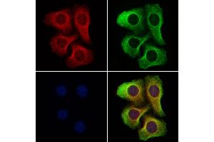 ABIN6262578 and ABIN6277333 staining Hela cells by IF/ICC. (IMMT Antikörper  (Internal Region))